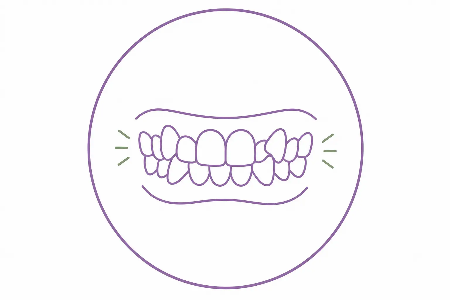 Illustration eines Gebisses mit Zahnengstand.